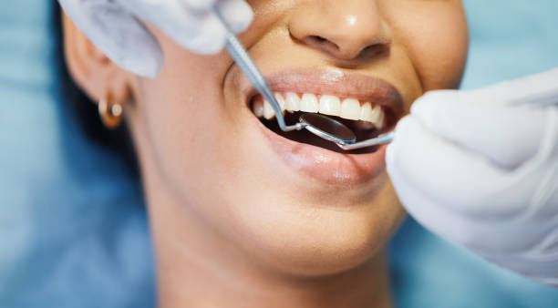 Best Broken or Chipped Tooth Repair in Hudson, NC