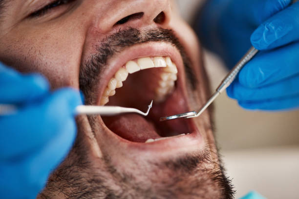 Best Emergency Treatment for Oral Infections in Hudson, NC