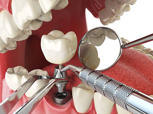 Reliable NC Emergency Dental Service Solutions